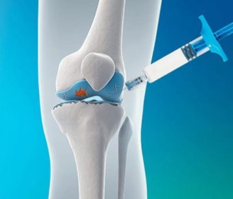 Vissco Supplementation